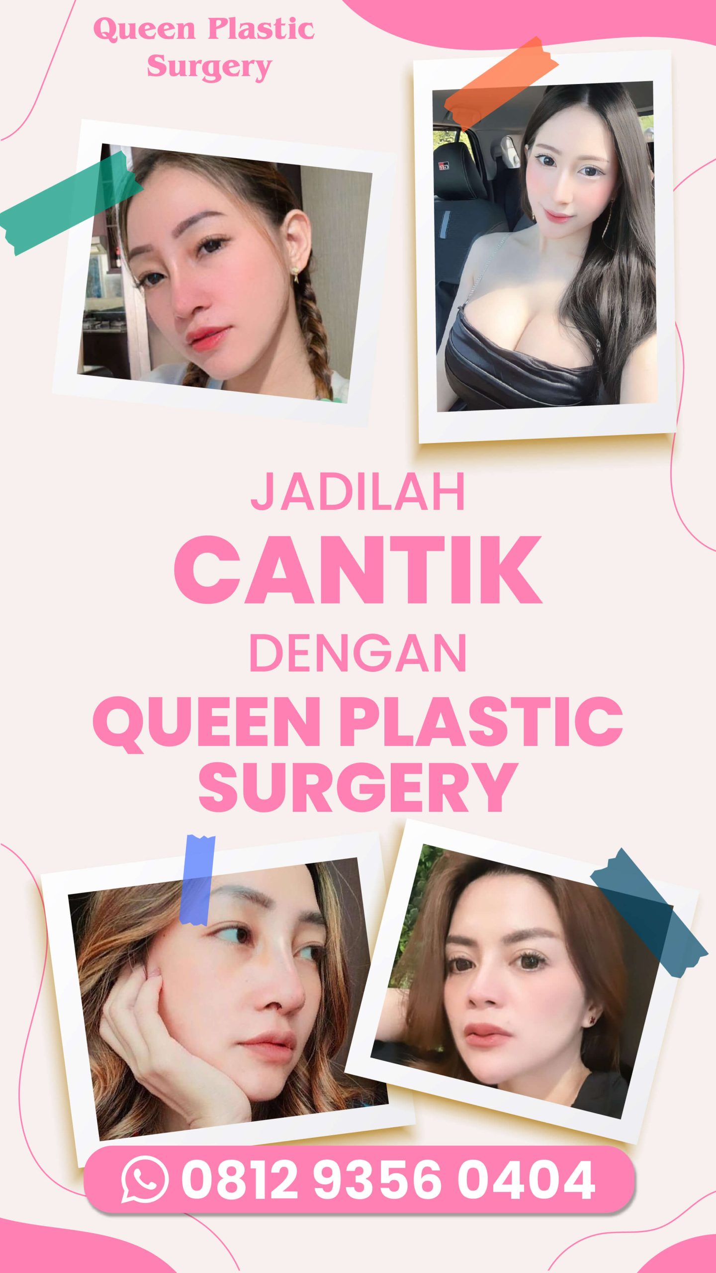 Banyak yang gak tahu! Ini rahasia bagaimana implan silikon justru bisa bikin hidung mancung super natural menurut Dr. Heri Noviana.