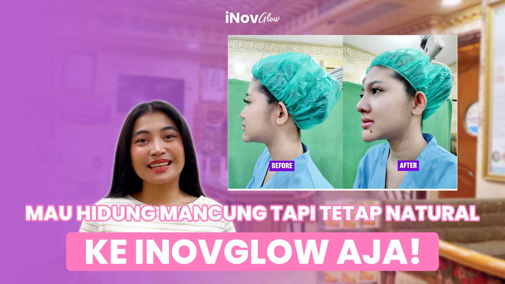 Pengguna kacamata garis keras baru selesai operasi hidung? 🛑 Hati-hati, pakai kacamata terlalu cepat bisa bikin hidung baru Anda miring! Cek tips Dr. Heri Noviana di sini.