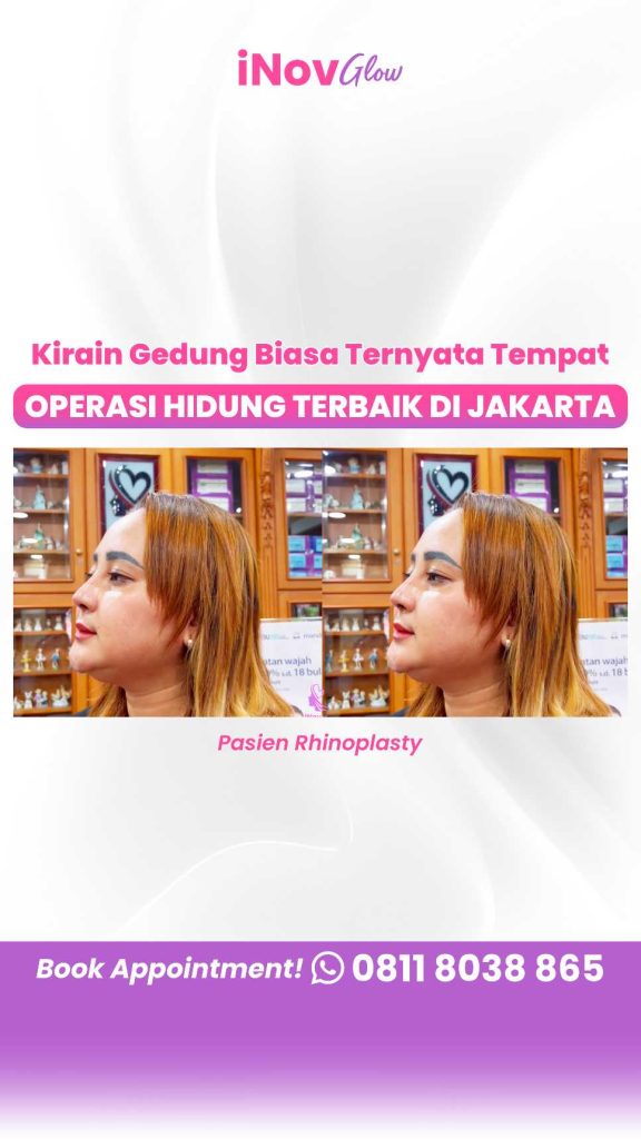 Mengapa kenyamanan psikologis pasca-operasi hidung dinilai jauh lebih berharga daripada perubahan fisiknya? 🧐 Temukan jawabannya dari Dr. Heri Noviana!