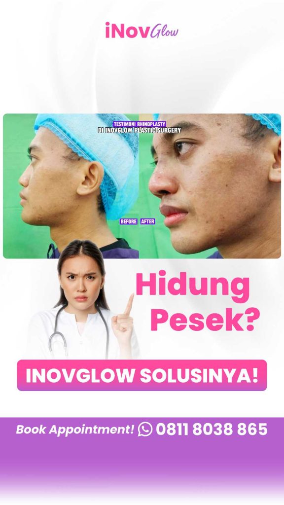 Investasi hasil hidung proporsional seumur hidup lewat disiplin nutrisi di minggu pertama. 💖 Dapatkan edukasinya dari Dr. Heri Noviana sekarang!