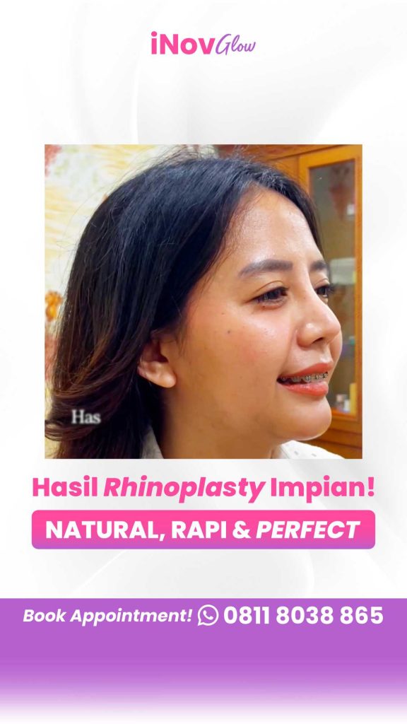 Diet setelah operasi hidung: Apa yang harus dimakan dan dihindari agar cepat sembuh? 👃 Hubungi Dr. Heri Noviana sekarang untuk konsultasi pasca-operasi.