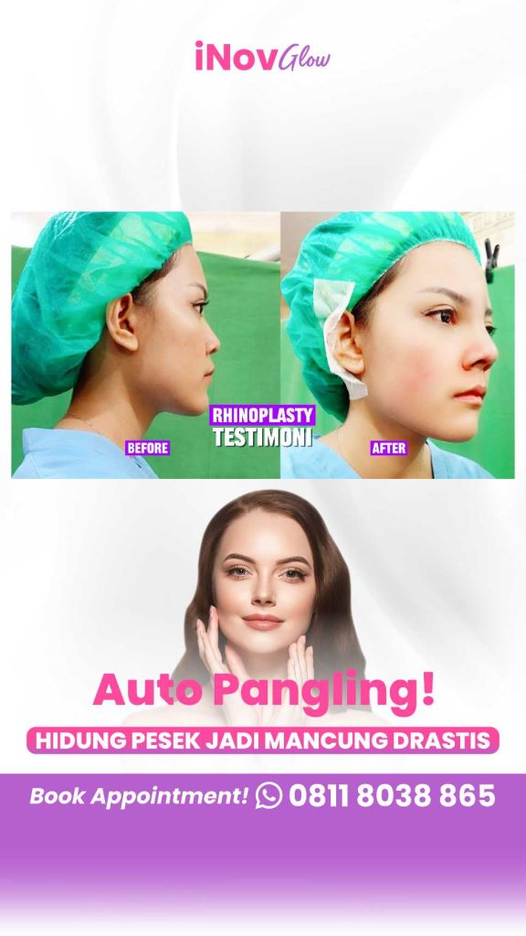 Rahasia di balik transformasi mental pasien setelah memiliki proporsi wajah yang harmonis. ✨ Yuk, intip edukasi menarik dari Dr. Heri Noviana di sini!