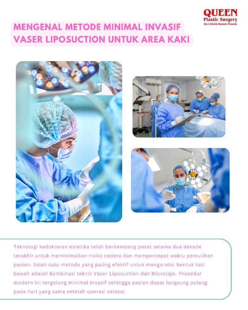 Liposuction Betis (Calf Liposuction): Solusi presisi untuk menyingkirkan 'lemak lokal' di area kaki bawah. 📐 Simak panduan lengkapnya dari Dr. Heri Noviana!