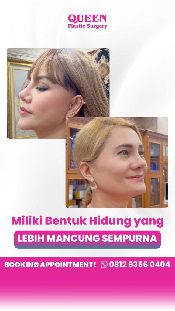Banyak yang gak tahu! Trik sederhana ini bisa pangkas waktu downtime operasi hidung Anda secara drastis. ✨ Simak kata Dr. Heri Noviana.