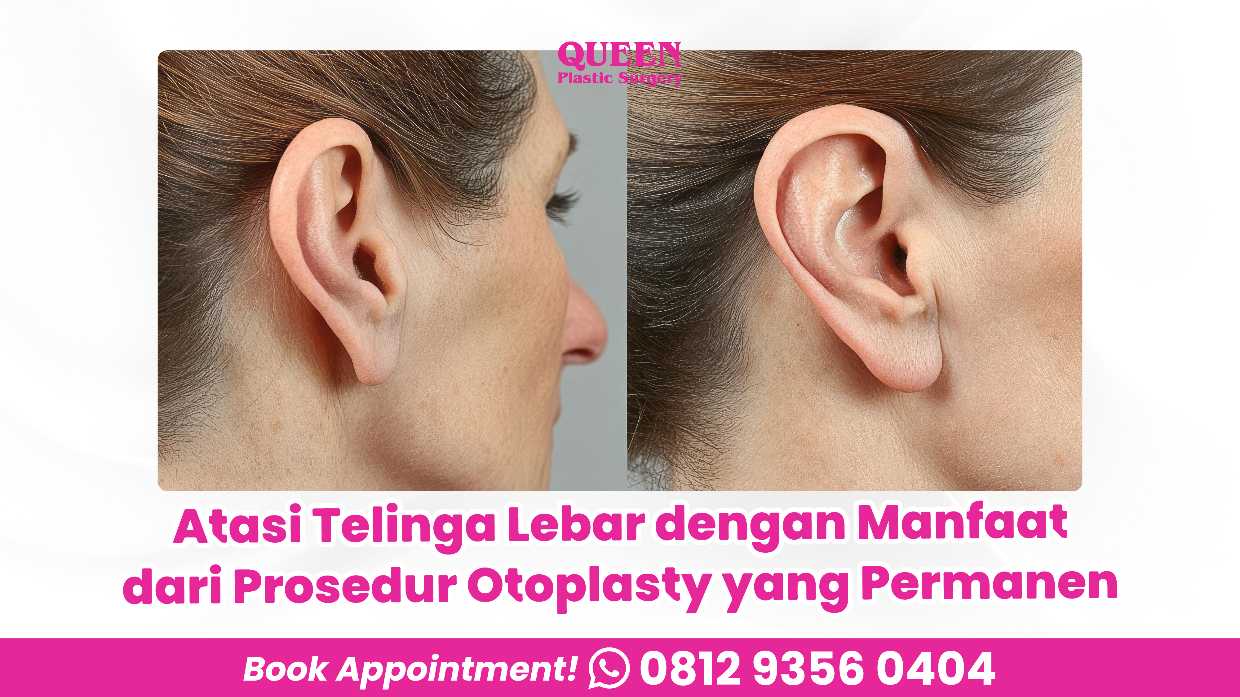Mengubah bentuk tulang rawan telinga agar proporsional seumur hidup? 💎 Cari tahu fakta medis Otoplasty bersama Dr. Heri Noviana di artikel ini.