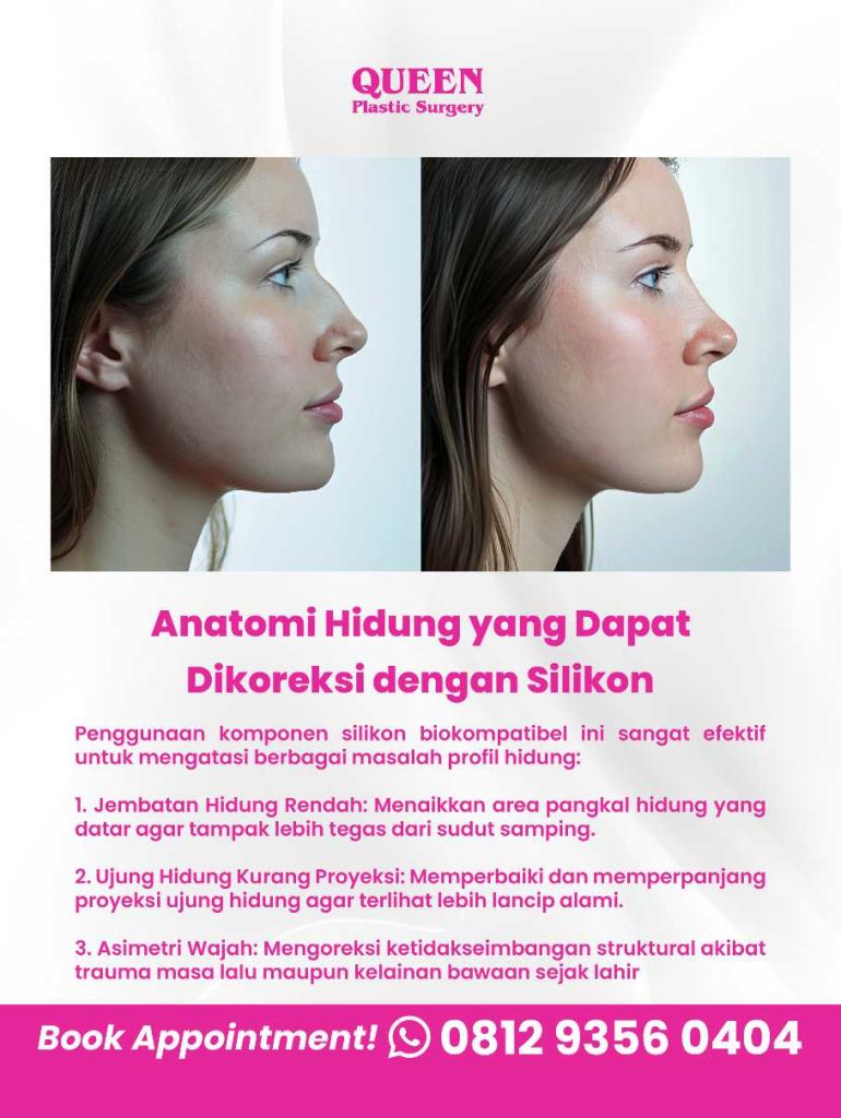 Bagaimana Dr. Heri Noviana mengukir (carving) implan silikon secara presisi demi hasil hidung yang menyatu alami dengan wajah? 💎 Cek di sini!