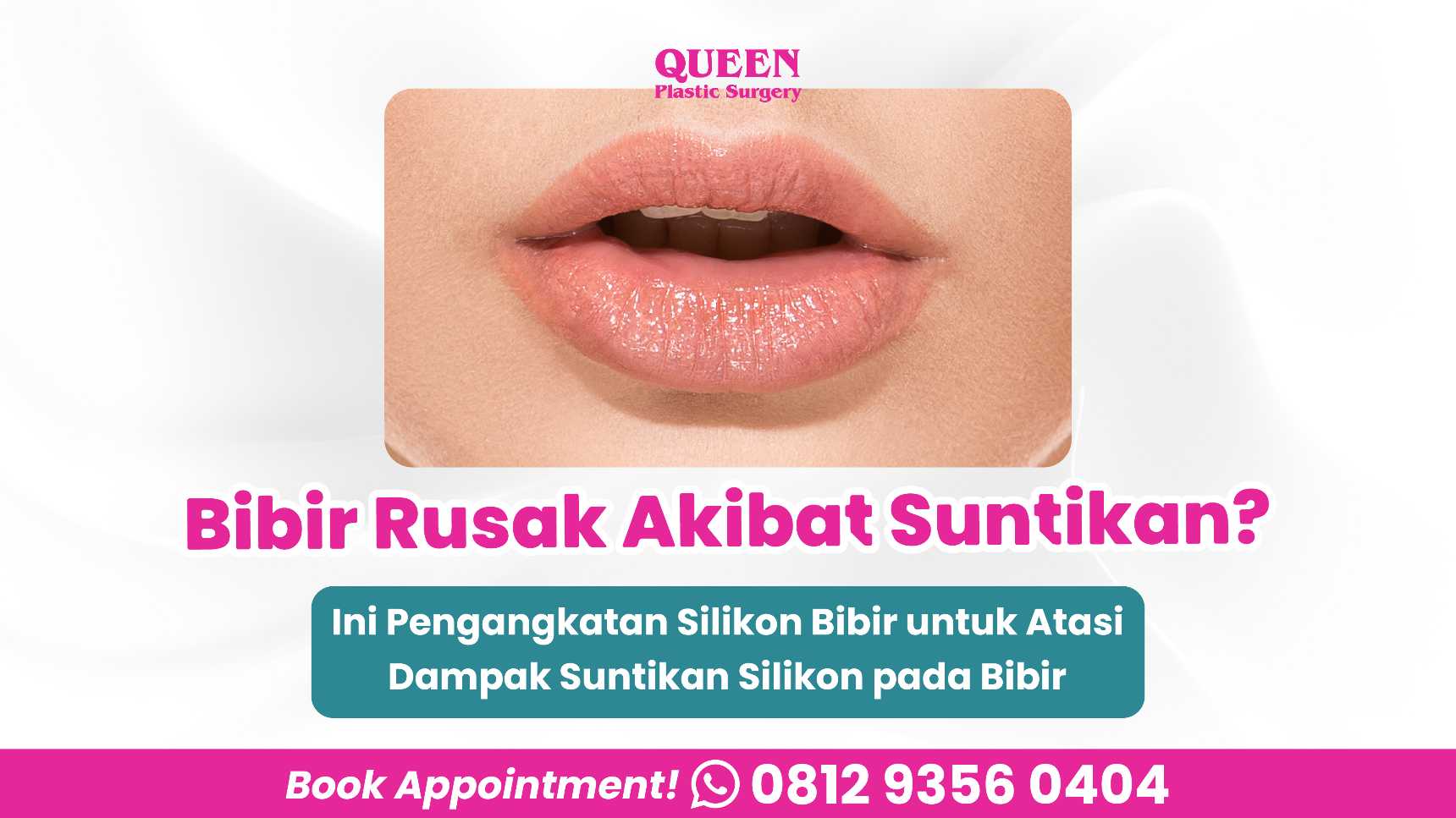 Bentuk bibir berubah drastis menyerupai 'bibir jontor' akibat filler abal-abal? 😲 Simak panduan evakuasi silikon bibir dari Dr. Heri Noviana.