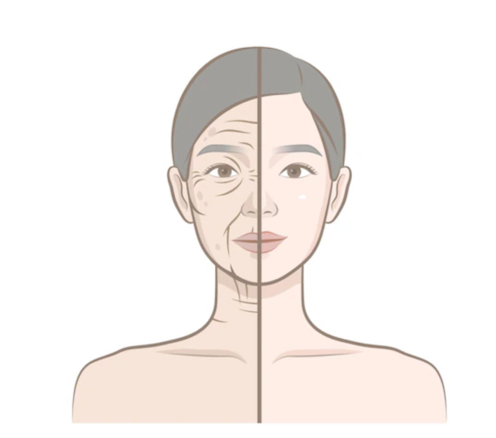 Rahasia membalikkan waktu dan mengencangkan rahang yang turun (jowls). 💎 Pelajari esensi prosedur Facelift dari Dr. Heri Noviana di artikel ini.