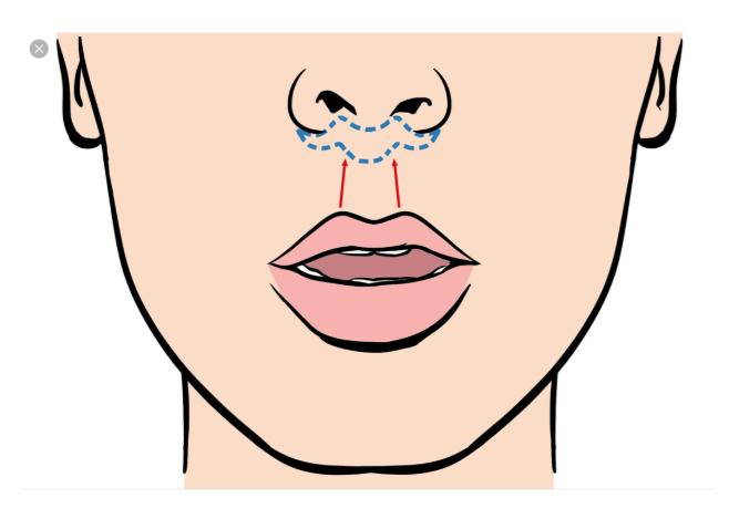 Tanpa drama bibir kelihatan kaku atau tidak bisa mingkem! 🙅‍♀️ Pelajari standar ukuran anatomi yang aman bersama Dr. Heri Noviana sekarang