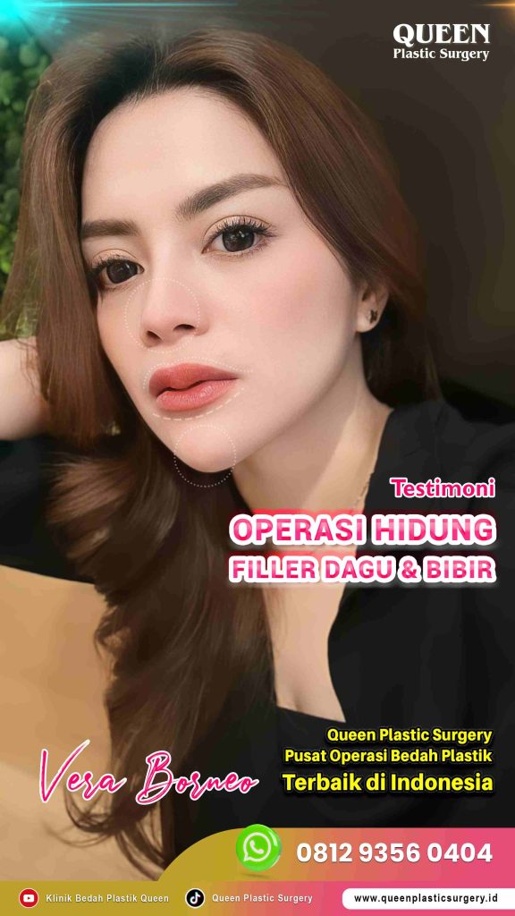 Mau hasil bibir bervolume yang natural dan aman jangka panjang? 🎭 Temukan teknik paling pas untuk anatomi wajah Anda bersama Dr. Heri Noviana.
