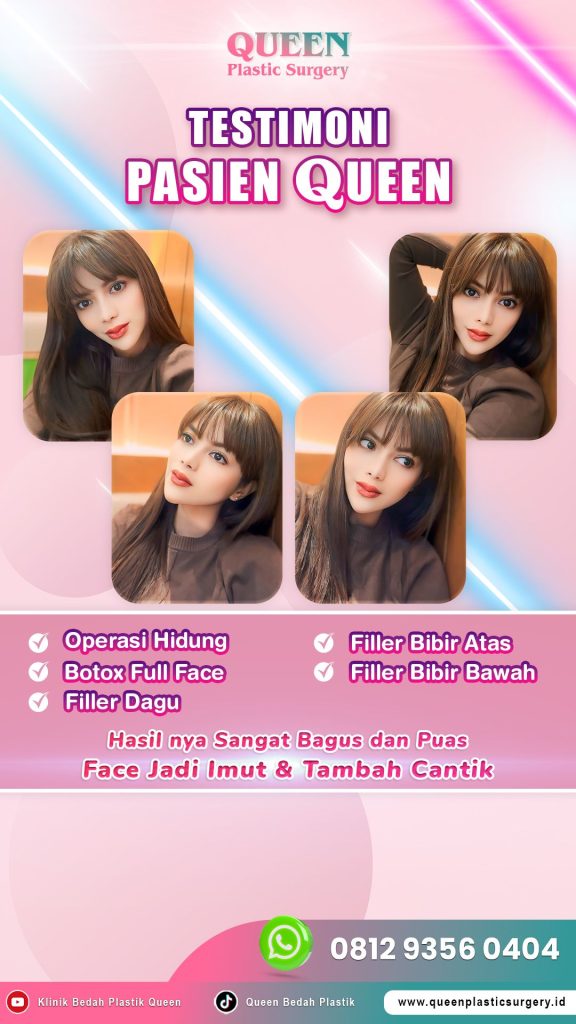 Hasil modifikasi bibir terbaik dimulai dari keputusan yang tepat. 👑 Cari tahu beda Filler Bibir & Implan Bibir bersama Dr. Heri Noviana!
