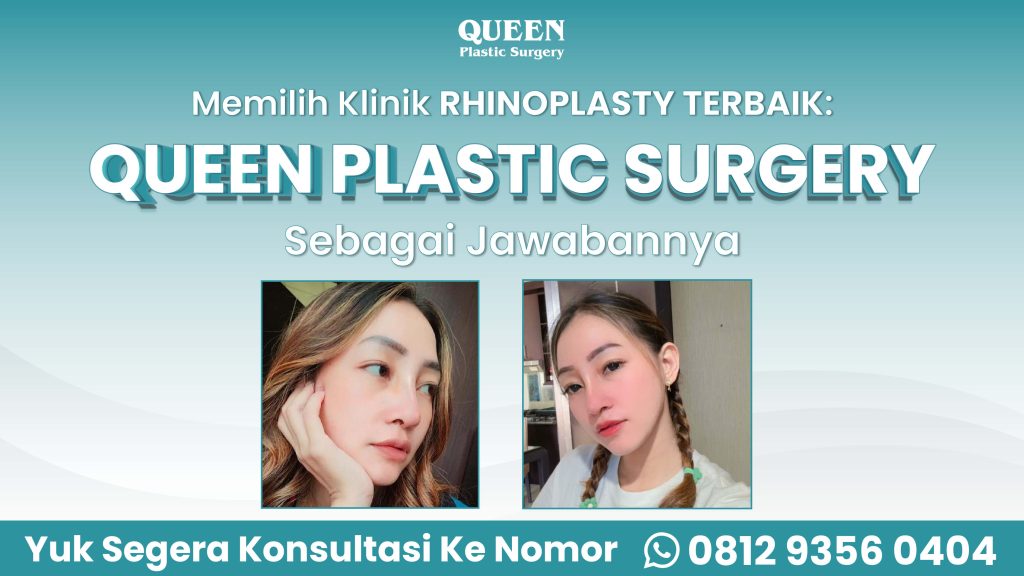 Miliki bentuk hidung ideal yang aman, permanen, dan ditangani oleh ahlinya. 📈 Simak panduan Dr. Heri Noviana hanya di artikel terbaru ini!
