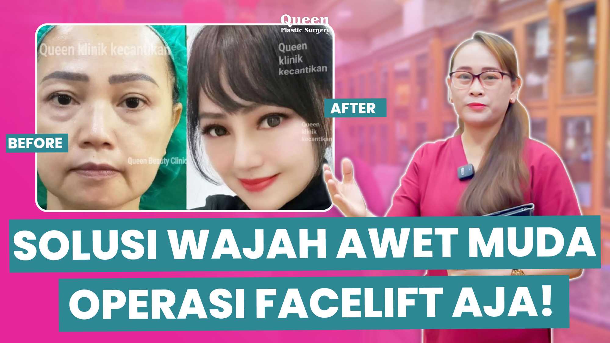 Kupas tuntas cara melenyapkan pipi kendor (jowls) dan kerutan leher dalam satu tindakan yaitu Facelift dengan teknologi modern bersama Dr. Heri Noviana!