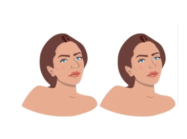 Banyak yang langsung nangis ketakutan karena hidung terbentur pasca-operasi. 🛑 Intip tanda bahaya tersembunyi dari Dr. Heri Noviana.