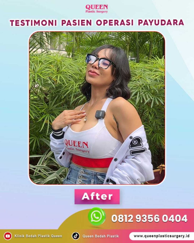 Banyak yang kaget! Pilihan profil implan payudara yang tepat ternyata bisa bikin lekuk tubuh kelihatan jauh lebih ideal dan tinggi proporsional. 😲 Simak Dr. Heri Noviana.
