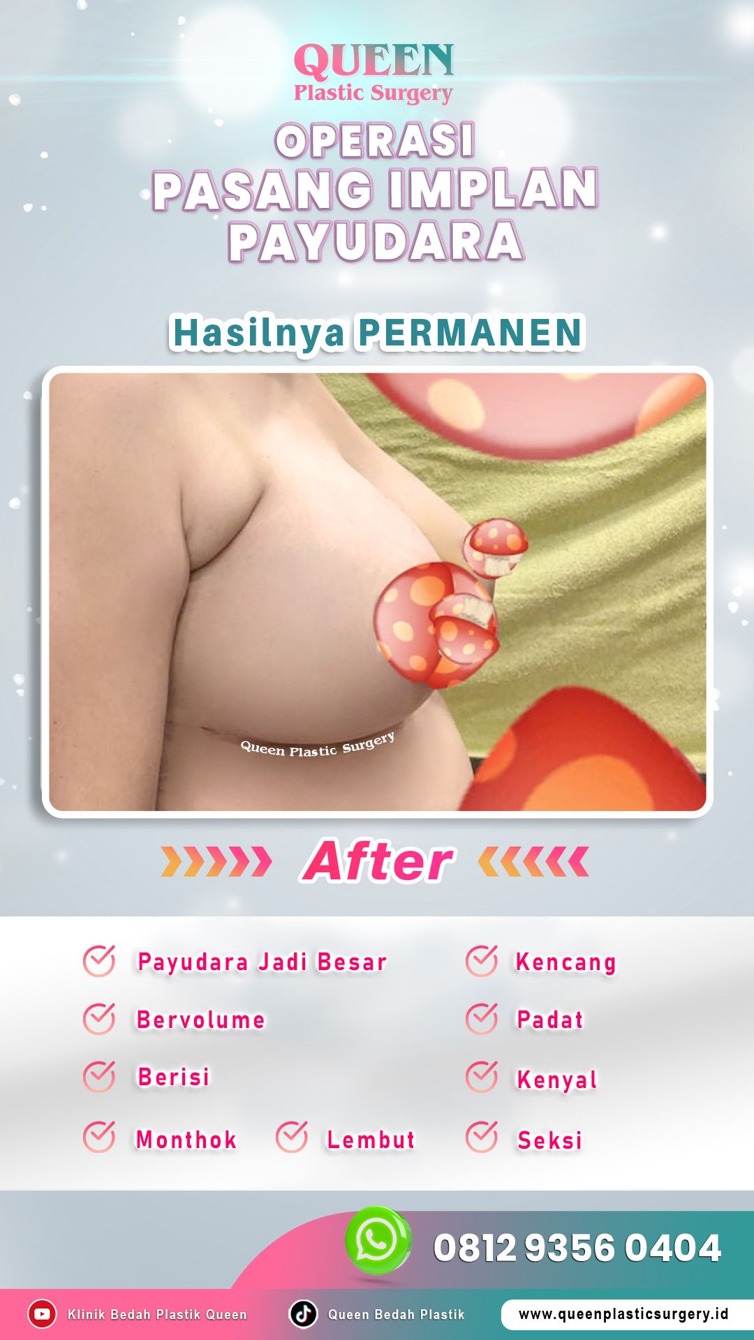 Beda jauh dari implan biasa! Ketahui kenapa transfer lemak payudara bikin payudara empuk dan terasa alami.