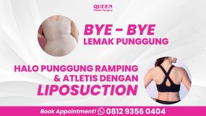 Liposuction punggung aman atau berbahaya? Temukan jawaban jujur dari pakar bedah plastik!