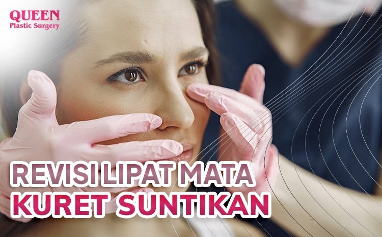 Nyesel lipatan mata kelihatan ketebalan atau aneh? Cek rahasia revisi blepharoplasty di sini!