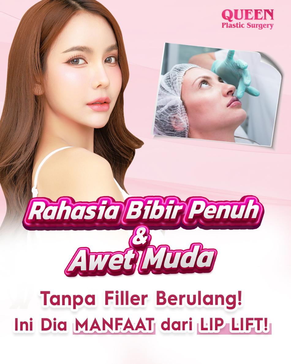 Mau bibir plump dan terangkat permanen tanpa bahan asing? Cek keajaiban prosedur lip lift di sini!