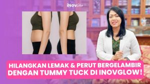 Dapatkan Perut Rata Ideal Tanpa Khawatir Masa Pemulihan Tummy Tuck! Pahami Tahapannya Sekarang. Hubungi tim Dr. Heri Noviana, Sp.BP-RE, M.Ked.Klin untuk jadwal sesi konsultasi!