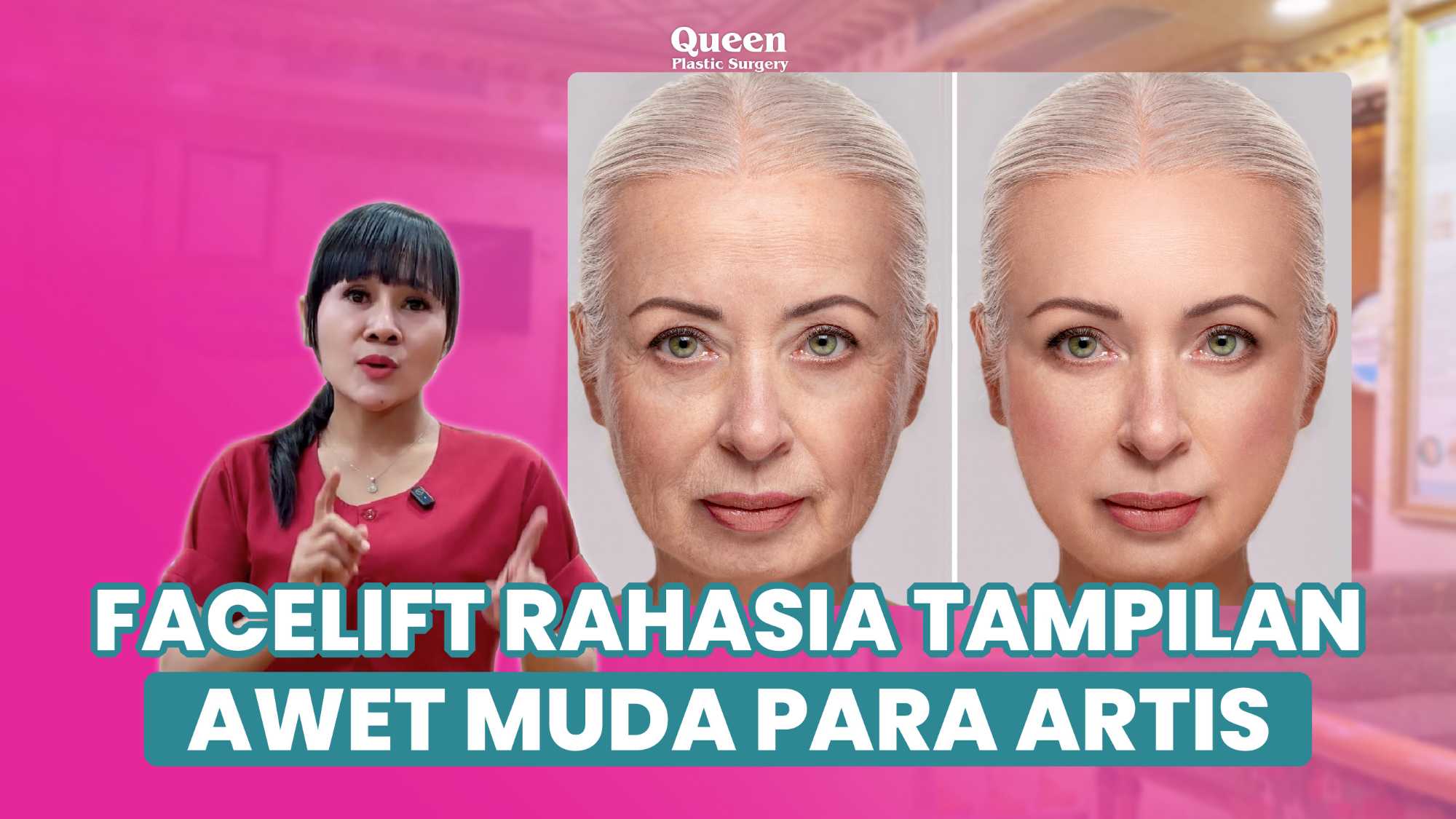 Dulu hasilnya sering kelihatan aneh, kenapa facelift zaman sekarang jauh lebih natural? Cek faktanya!