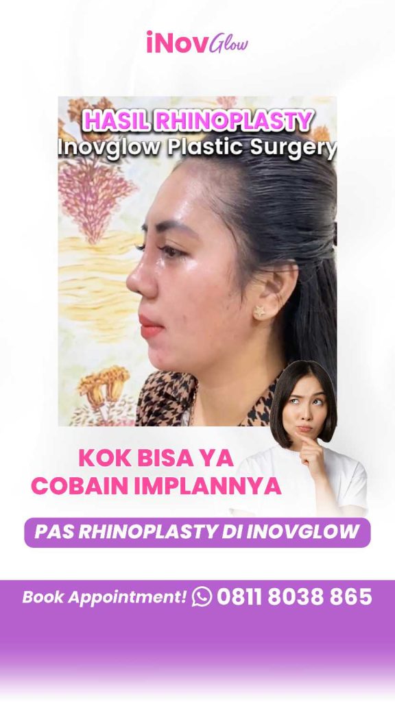 Rahasia Napas Lega & Tampil Percaya Diri Terbongkar! Bagaimana Proses Operasinya? Dapatkan jawabannya & konsultasi langsung dengan Dr. Heri Noviana!
