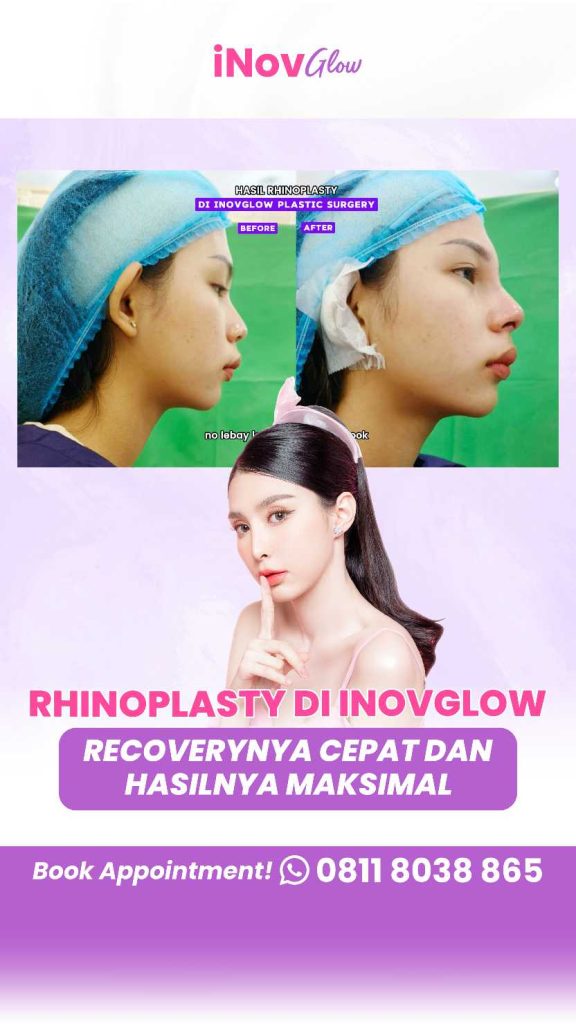 Hidung Proporsional dan Bebas Mampet Tahan Seumur Hidup? Cek Kombinasi Manfaat Rhinoplasty Sekarang! Solusinya ada di konsultasi Dr. Heri Noviana, Sp.BP-RE, M.Ked.Klin!