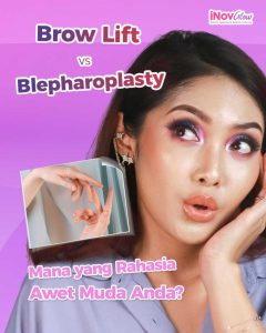 Tertarik Operasi Kelopak Mata? Pahami Alasan Dokter Gabungkan Blefaroplasti dengan Brow Lift. Klik link untuk buat janji dengan Dr. Heri Noviana!