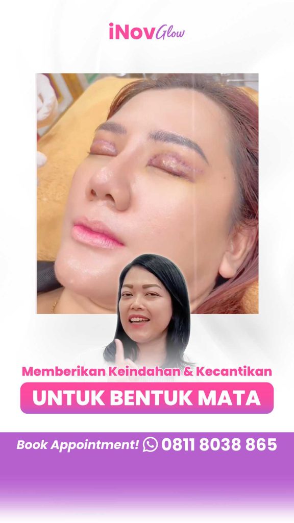 Atasi Kelopak Mata Asimetris & Cacat Pasca Bedah Langsung dari Ahlinya! Dapatkan edukasi lengkap dari Dr. Heri Noviana, klik di sini!