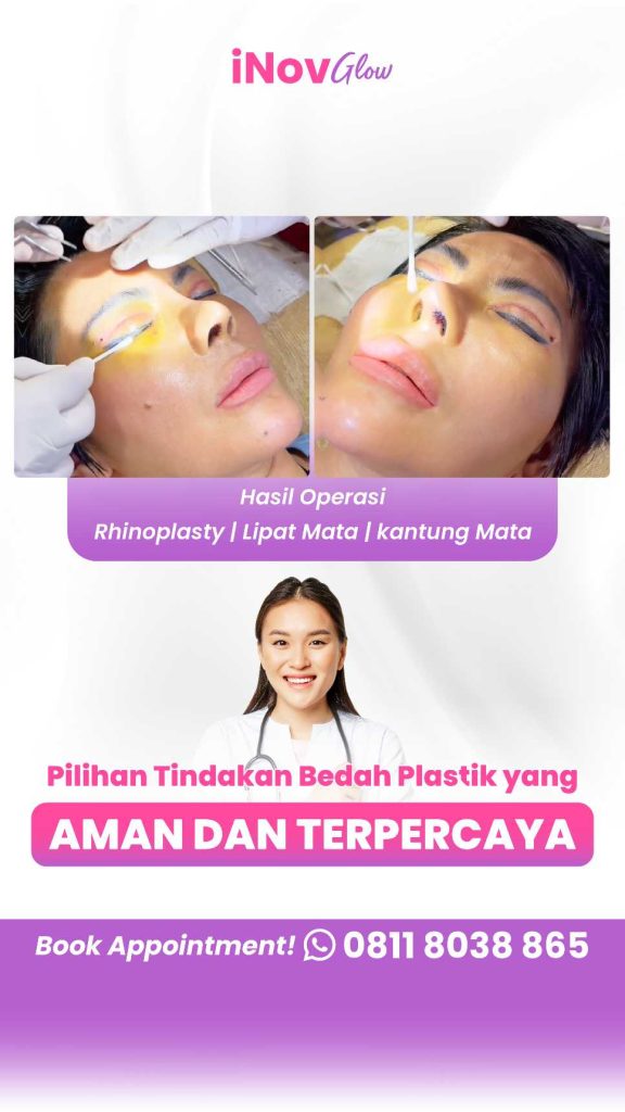 Mengapa Dokter Spesialis Rekomendasikan Revisi Blefaroplasti untuk Hasil Gagal? Cek Penjelasannya! Mulai konsultasi bersama Dr. Heri Noviana, Sp.BP-RE, M.Ked.Klin!