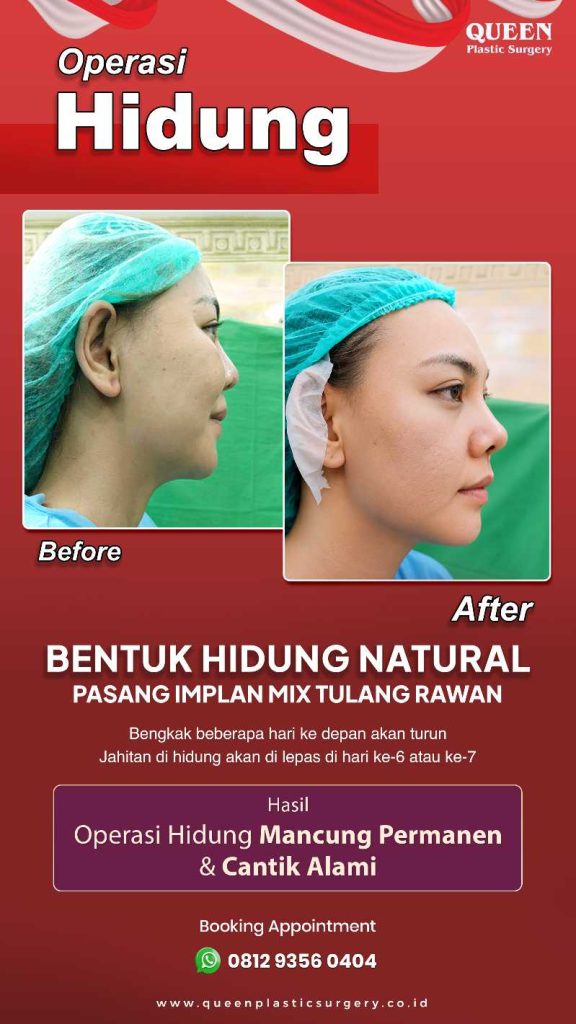 Rahasia terbebas dari profil wajah kurang seimbang! Sudah tahu cara menyempurnakan bentuk hidung belum?