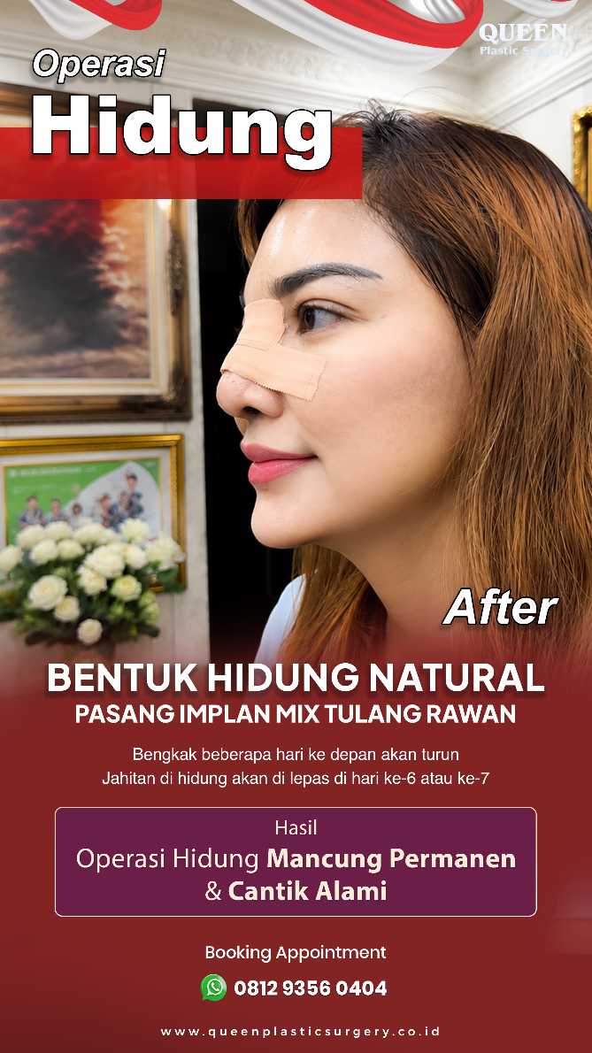 Bikin kontur wajah makin tegas dari tampak samping! Ketahui metode penyempurnaan hidung terkini.