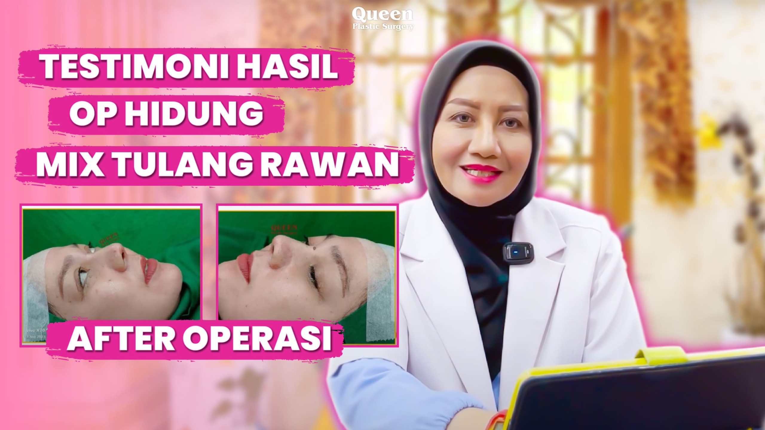 Beda kondisi hidung, beda pilihan bahan! Intip trik medis memilih material rhinoplasty dari ahlinya.