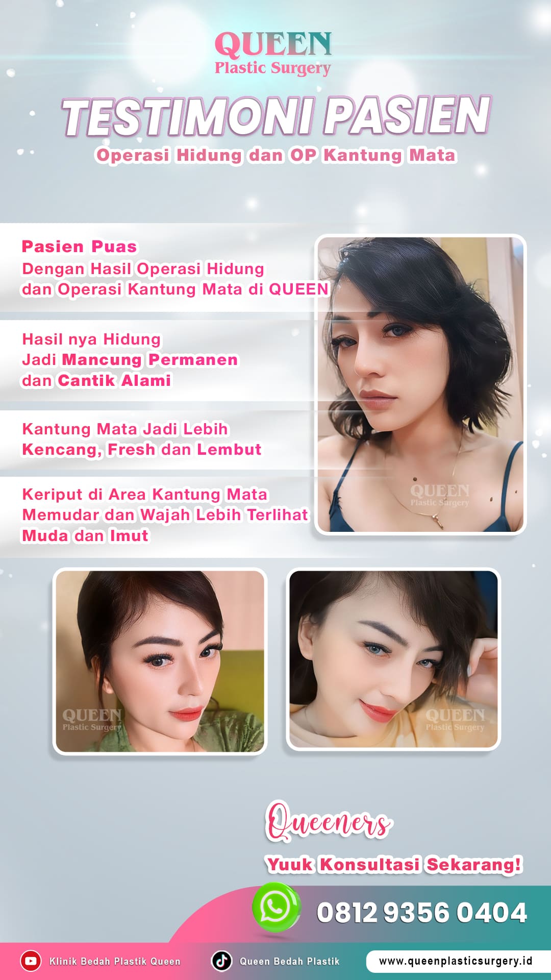Rahasia kantong mata kembali kencang dan segar alami terungkap! Simak keajaiban blefaroplasti di sini.