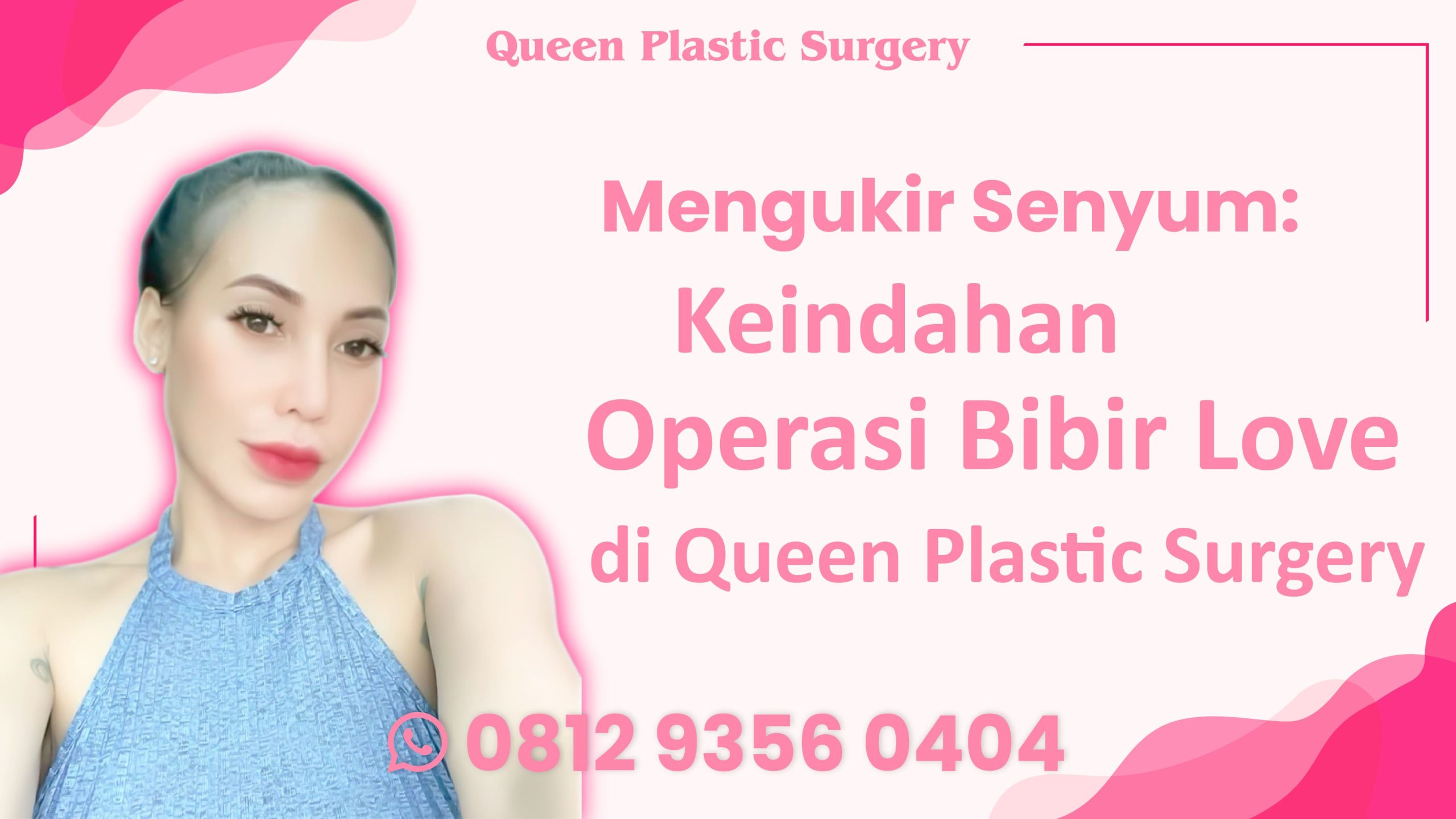 Bikin Senyum Makin Menawan dan Jadi Pusat Perhatian Setelah Melakukan Cheiloplasty