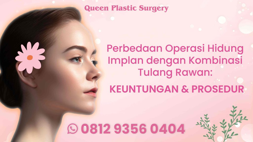 Takut hasil rhinoplasty kelihatan kaku atau jebol? Simak keunggulan cangkok tulang rawan alami!