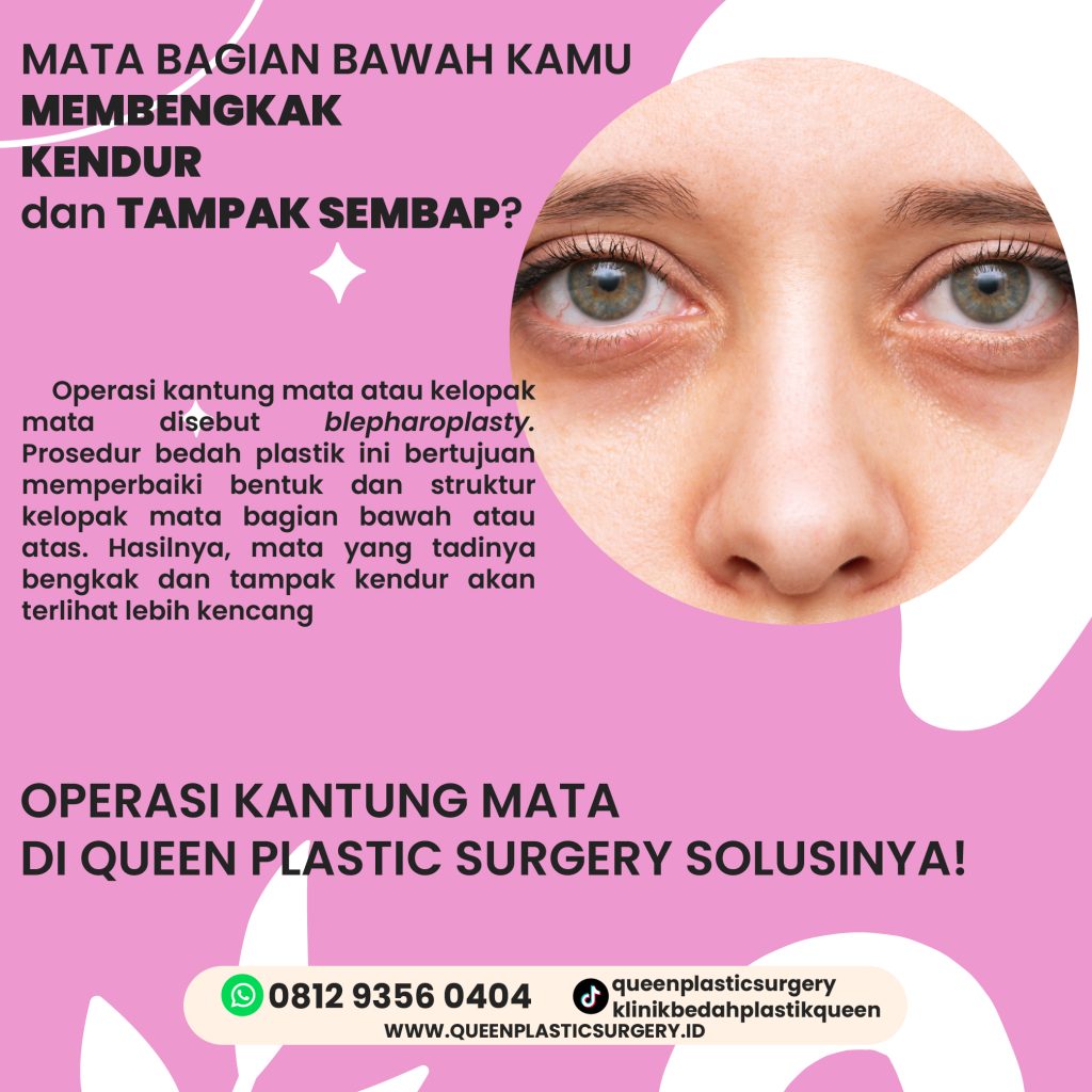 Infografis tahapan tindakan medis sebagai solusi kantung mata kendur.