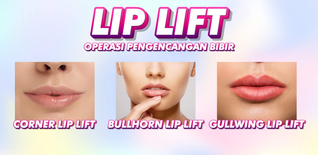 Ingin kontur bibir terdefinisi dengan rasio ideal terhadap hidung? Wajib paham konsep satu ini dengan Lip Lift!