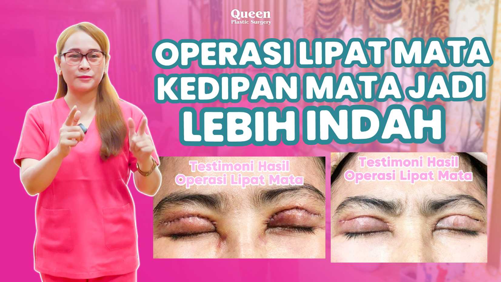 Wujudkan bentuk mata ideal, terbuka lebar, dan lebih binar alami. Simak edukasi spesialisnya sekarang juga!
