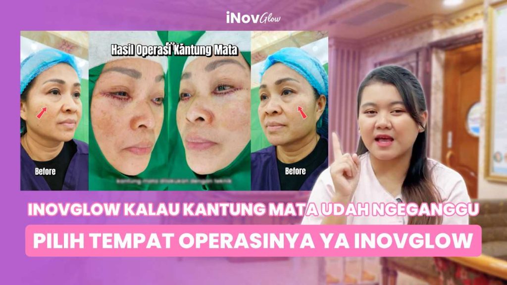 Mengapa Skincare Biasa Sulit Hilangkan Kerutan Bawah Mata? Cek Alasan Medis & Solusinya! Konsultasi awal dengan Dr. Heri Noviana di link ini!