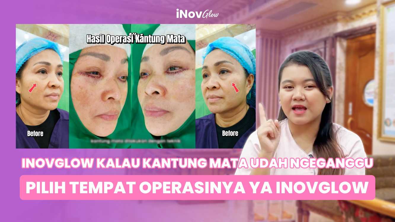 Mengapa Skincare Biasa Sulit Hilangkan Kerutan Bawah Mata? Cek Alasan Medis & Solusinya! Konsultasi awal dengan Dr. Heri Noviana di link ini!