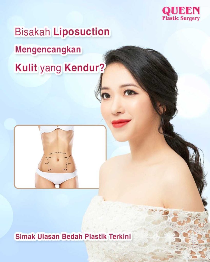 STOP mengira liposuction adalah cara mengencangkan kulit kendor secara instan! Pahami batas kemampuannya di sini. 👉 Jadwalkan konsultasi medis terpercaya bersama Dr. Heri Noviana, Sp.BP-RE, M.Ked.Klin hari ini!