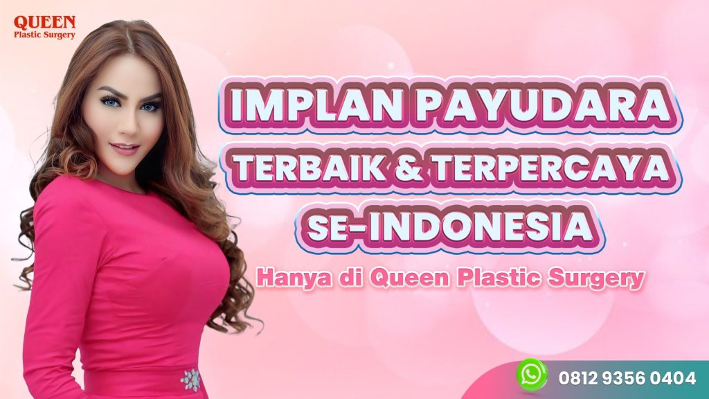Panduan memilih merk implan payudara Motiva vs Mentor: Mana yang lebih bagus? sesuai kebutuhan.