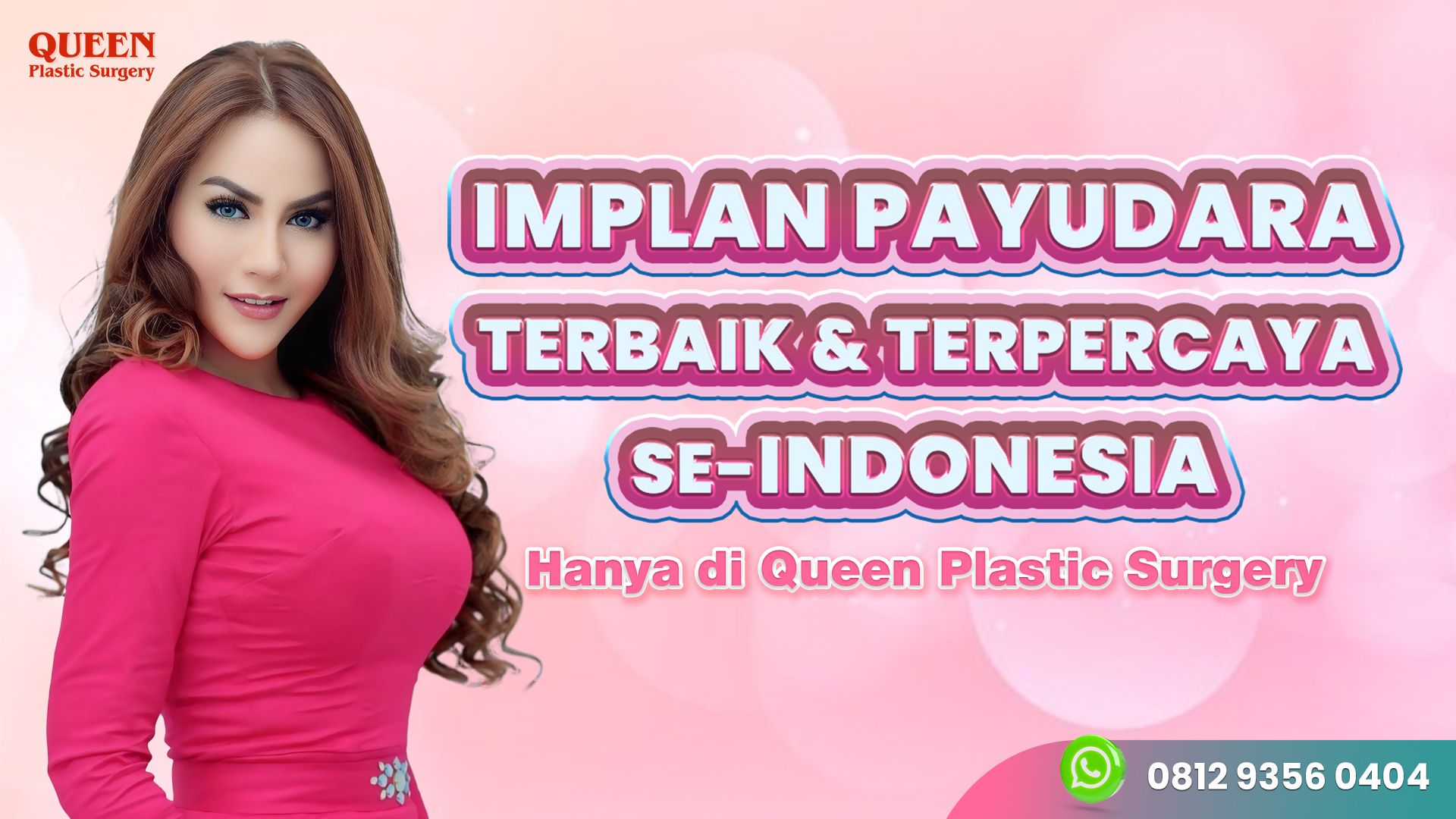Panduan memilih merk implan payudara Motiva vs Mentor: Mana yang lebih bagus? sesuai kebutuhan.