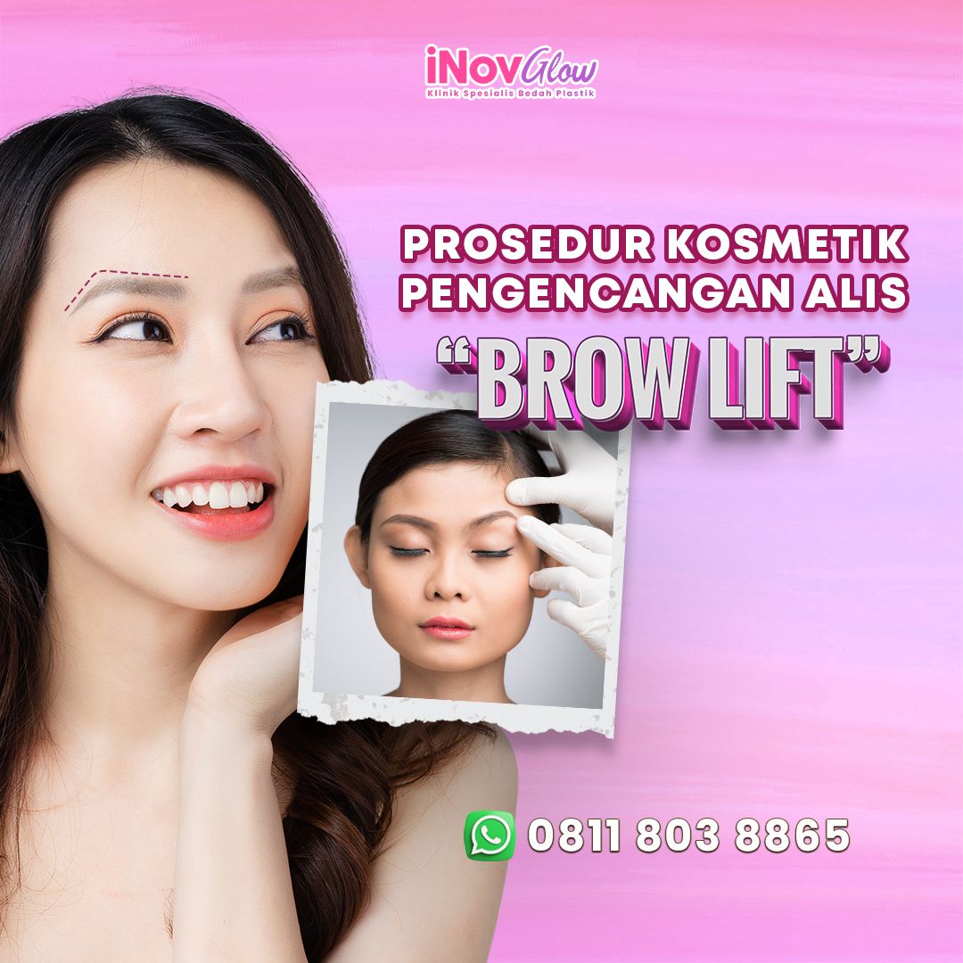 Takut Dibilang Muka Kaget Usai Operasi? Ini Timeline Asli Pemulihan Brow Lift yang Jarang Diungkap Dokter! Konsultasi dengan Dr. Heri Noviana, Sp.BP-RE, M. Ked. Klin sekarang!