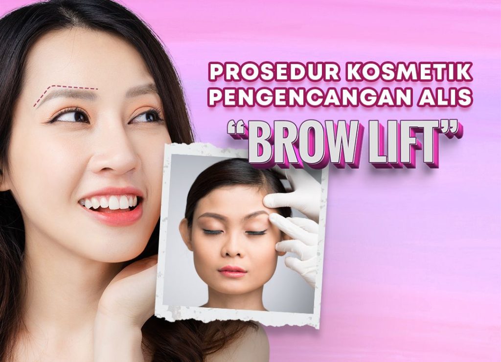 Wajah kelihatan galak atau lelah gara-gara alis turun dan hooded eye? Ketahui jawaban medis prosedur brow lift dan baca panduan Prosedur Liposuction Punggung untuk Kontur Tubuh Ideal. 👉 Konsultasikan estetika wajah atas Anda dengan Dr. Heri Noviana, Sp.BP-RE, M.Ked.Klin sekarang!