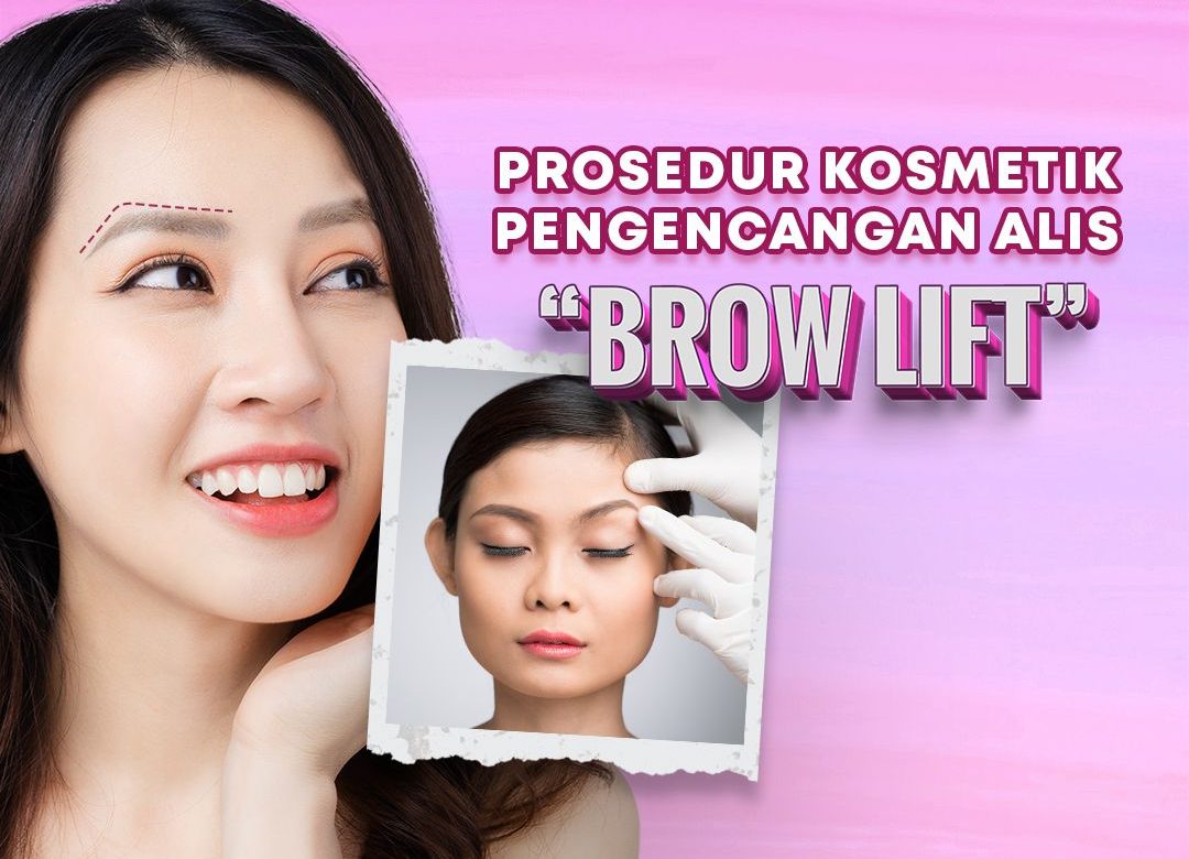 Apakah Brow Lift Dapat Memperbaiki Mata Kendur (Hooded Eye)?