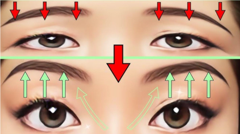 Brow Lift vs Blepharoplasty: Mana yang paling efektif mengoreksi hooded eye pada wajahmu? Bandingkan juga teknik peremajaan kulit pada artikel Kombinasi Facelift dan Transfer Lemak Wajah untuk Hasil Alami.

👉 Temukan tindakan peremajaan terbaik untuk Anda bersama Dr. Heri Noviana, Sp.BP-RE, M.Ked.Klin!