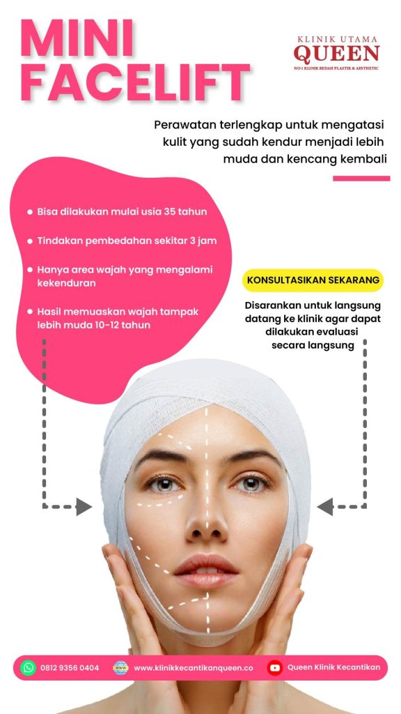 Jangan tunggu wajah kuyu parah! Ini tanda-tanda usia dan kondisi kulit yang pas untuk mini facelift.