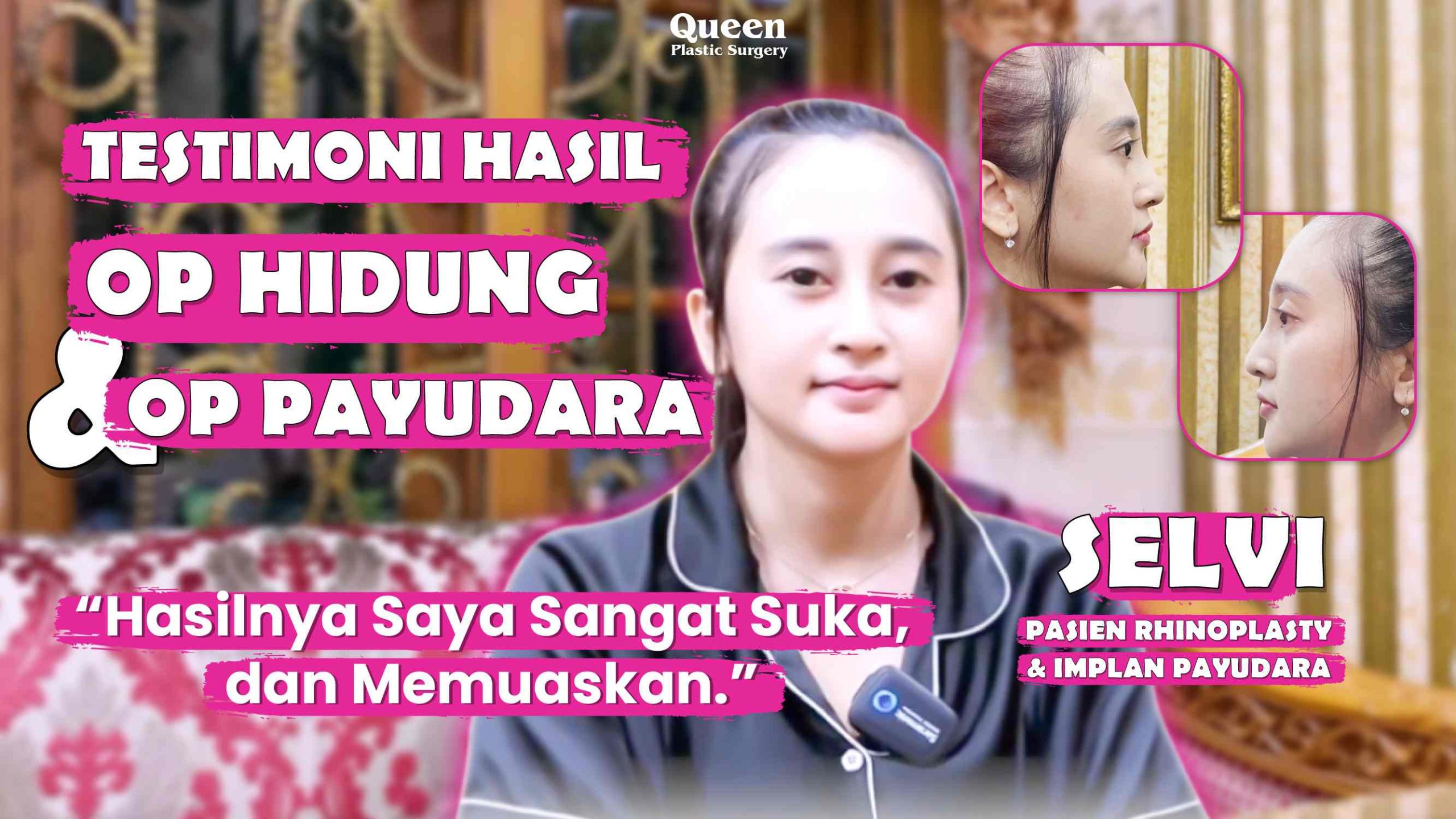Implan payudara tahan berapa lama sih? Cek fakta medis dan tips memperpanjang usia implan di sini.